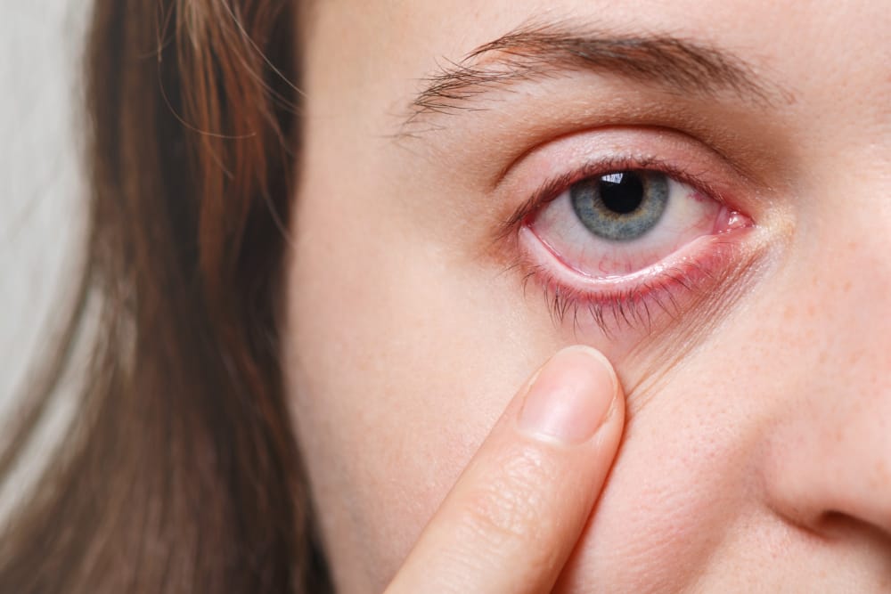 Signs of Eye Infections